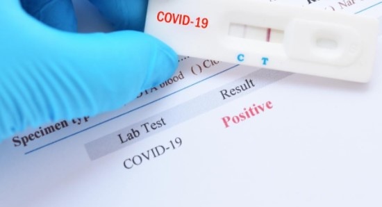 3869 са новите случаи на коронавирус у нас за последните